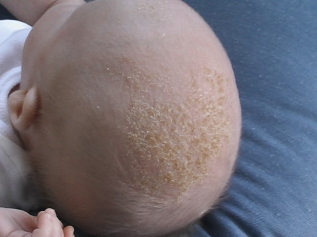 A close-up of a baby's head

Description automatically generated